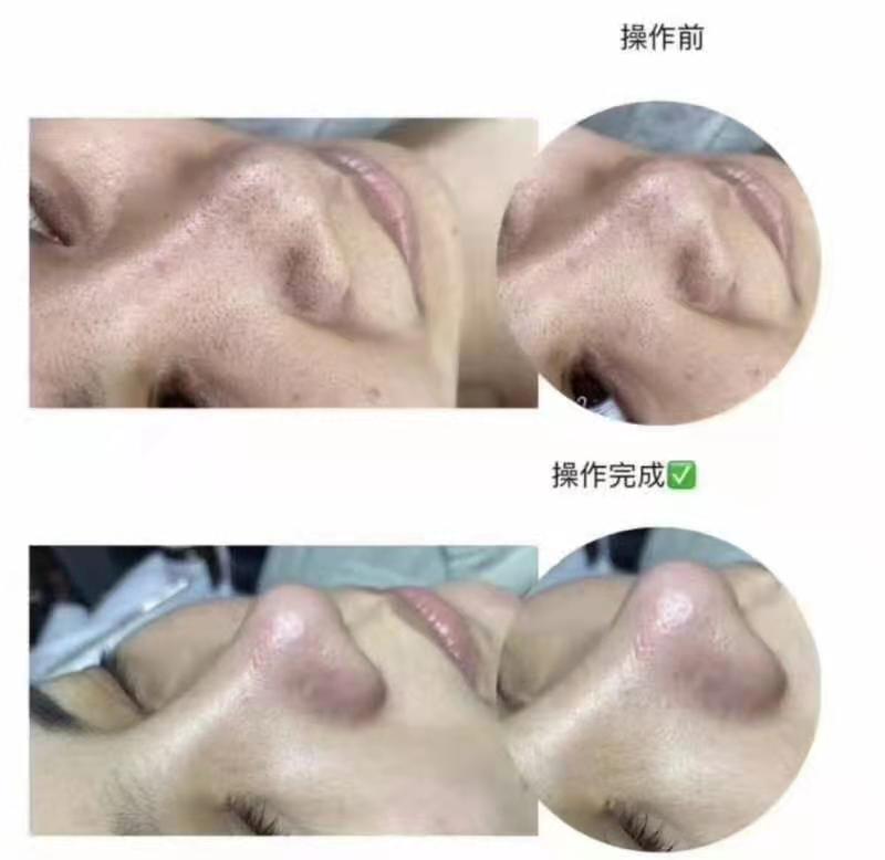 皮膚管理作品