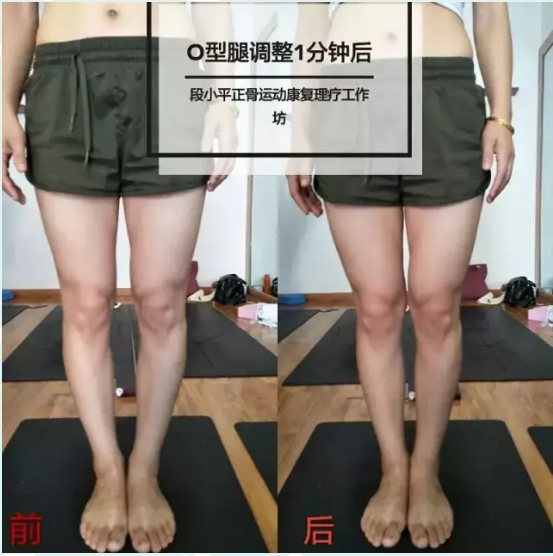 對比照